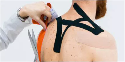 Kinesiological McConnell Taping